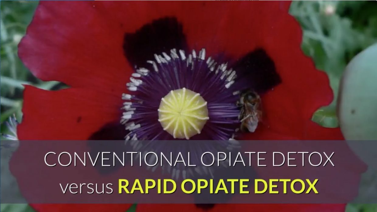 Convention avs rapid opiate detoxification treatment
